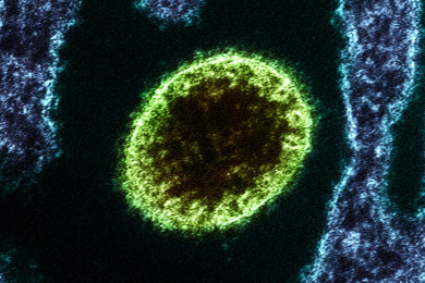 Wabah Virus Nipah Melanda India, Indonesia Tingkatkan Kewaspadaan