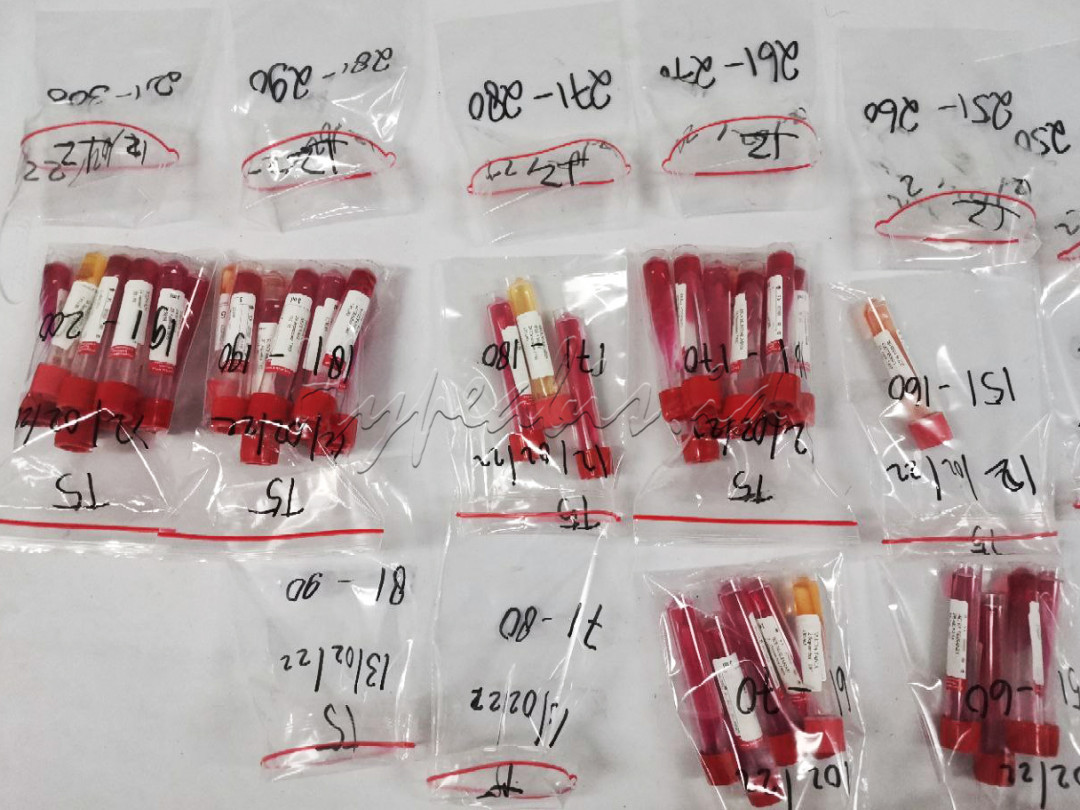 Sampel cairan dari para pasien COVID-19 di Wisma Atlit, Jakarta Pusat. Untuk uji lab, guna menentukan apakah hasilnya negatif atau masih positif corona.<br />
Sehingga pasien bisa dinyatakan sembuh dan diperbolehkan untuk pulang jika hasil test negatif, atau masih harus menjalani rawat inap jika hasil test masih menunjukan positif.