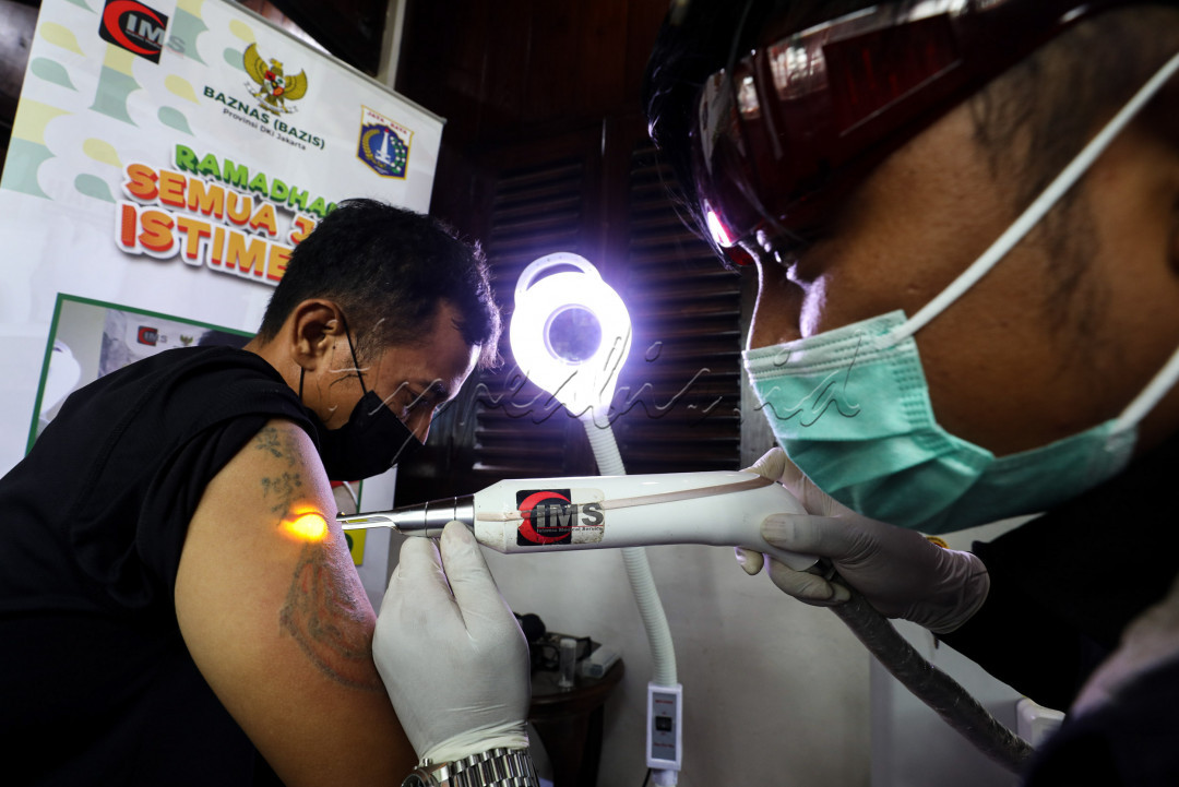 Beberapa syarat hapus tato gratis yaitu dinyatakan sehat oleh dokter yang umumnya tersedia di lokasi kegiatan, dan yang paling utama adalah sudah hijrah atau punya keinginan kuat untuk hijrah, bukan untuk menggantinya dengan gambar-gambar baru.