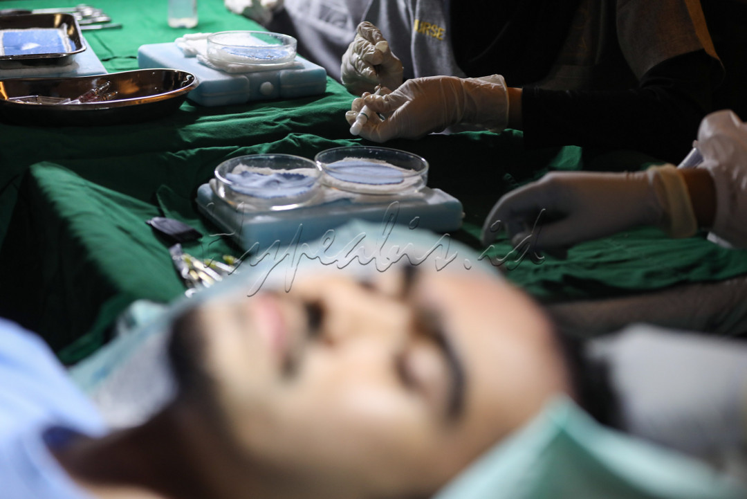 Kebanyakan pasien akan merasakan hasil cangkok rambut dalam rentang waktu 6-9 bulan setelah treatment dilakukan.